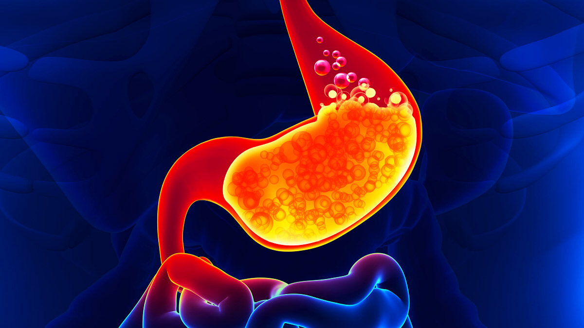 GASTRITIS-ENDOGASTRO-PUNO